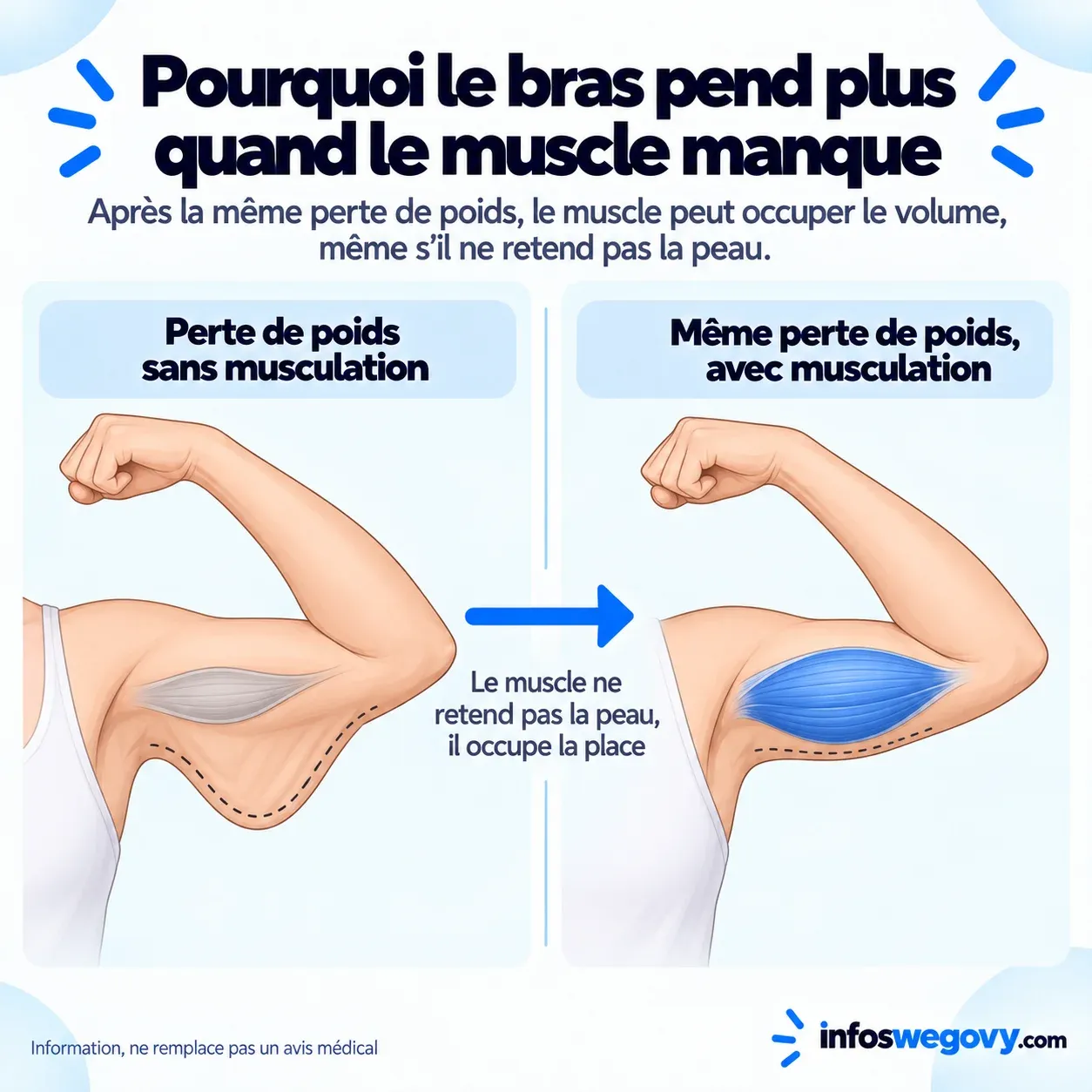 Comparaison de deux bras après la même perte de poids, l'un sans musculation avec la peau qui pend, l'autre avec un triceps entretenu qui occupe le volume