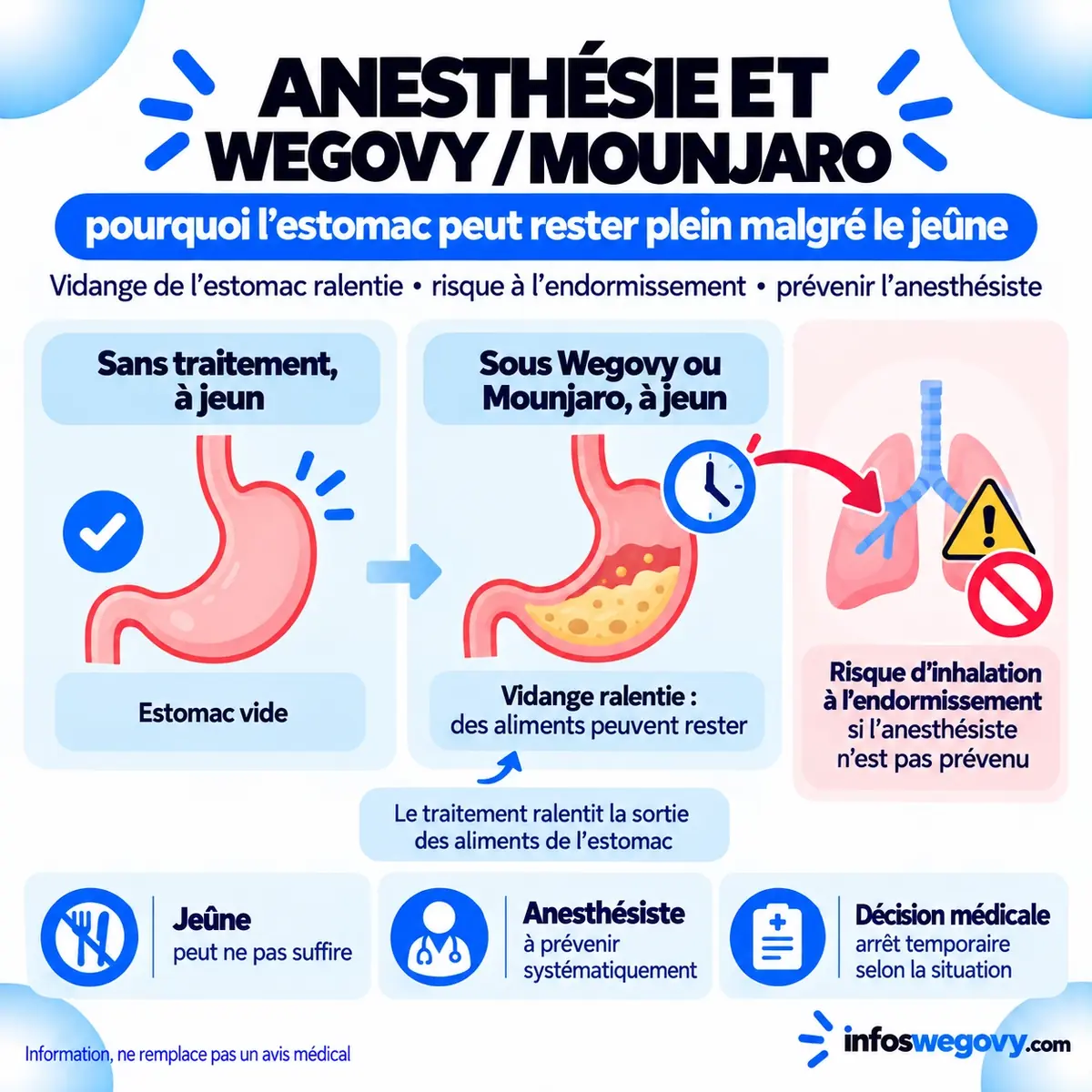 Schéma montrant que le Wegovy et le Mounjaro ralentissent la vidange de l'estomac, qui peut rester plein malgré le jeûne avant une anesthésie